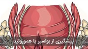 پیشگیری از بواسیر یا هموروئید با تصحیح سبک زندگی و سلامت گوارش