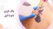 پاک کردن تاتو ابرو و بدن در بابل
