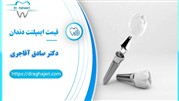 قیمت ایمپلنت دندان