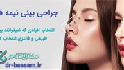 چرا مدل بینی نیمه فانتزی ترند شده است؟