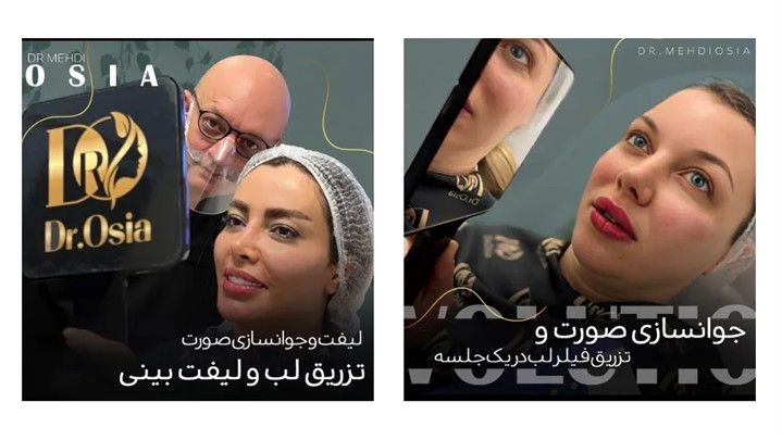 بهترین دکتر تزریق ژل لب سال ۱۴۰۱ در تهران بهترین دکتر تزریق ژل لب سال ۱۴۰۱ در تهران