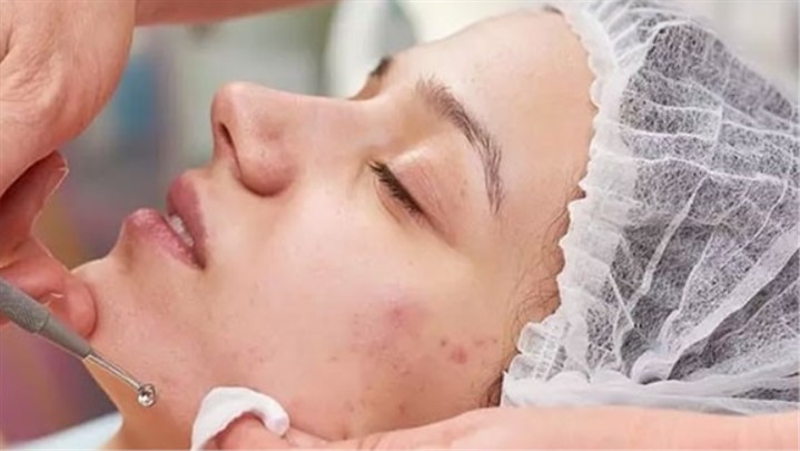 آموزش انجام فیشیال و پاکسازی پوست صورت