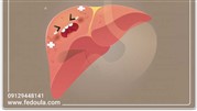 نشانه های کبد چرب چگونه و چه موقع خود را نشان می دهند؟