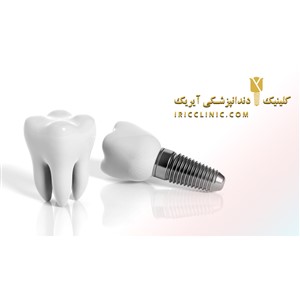 کلینیک دندانپزشکی آیریک