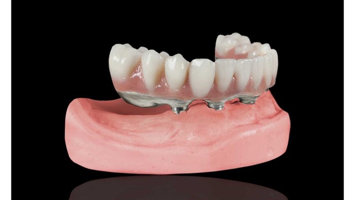 دندان مصنوعی، بهترین راه برای جبران بی دندانی!