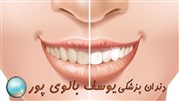چه کنیم دندان هایی مرتب داشته باشیم؟