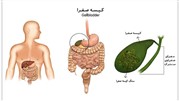 مهم ترین راه های تشخیص و درمان سنگ صفرا | فدولا