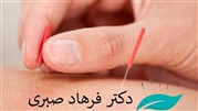آیا طب سوزنی در درمان بیماری‌ها موثر است؟
