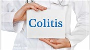بهترین روش های غیر دارویی درمان کولیت عصبی