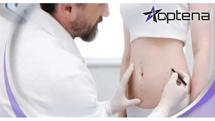 کاندیدای مناسب جراحی پیکرتراشی کاندیدای مناسب جراحی پیکرتراشی