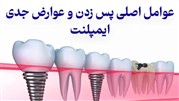 عوامل اصلی پس‌زدن و عوارض جدی ایمپلنت