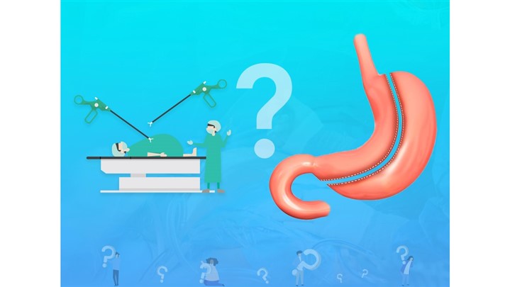 جدیدترین روش عمل لاغری جدیدترین روش عمل لاغری