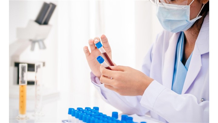 چکاب سالانه با آزمایش خون