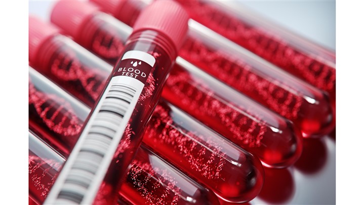 چکاب سالانه با آزمایش خون