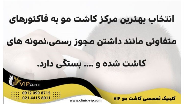 بهترین مرکز کاشت مو کجاست معیارهای انتخاب بهترین کلینیک کاشت مو