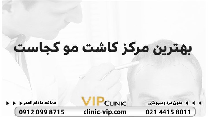 بهترین مرکز کاشت مو کجاست معیارهای انتخاب بهترین کلینیک کاشت مو