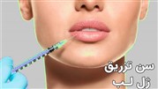سن تزریق ژل