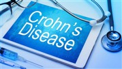 درمان کرون با روش‌های جراحی کلینیک زارعی