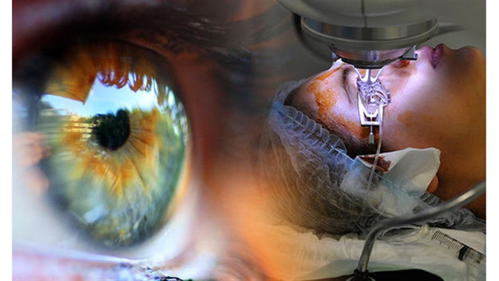تفاوت جراحی کاشت لنز با لیزیک [کدام یک بهتر است]