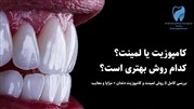 تفاوت کامپوزیت ونیر و لمینت سرامیکی چیست؟