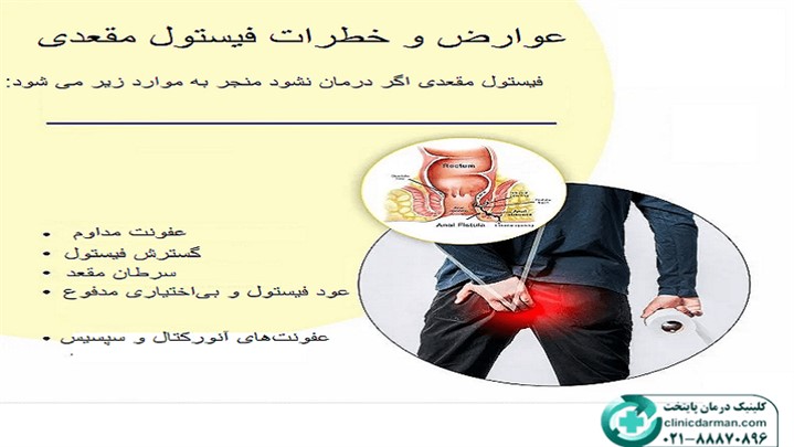 آیا فیستول به خودی خود خوب میشود؟ آیا فیستول به خودی خود خوب میشود؟