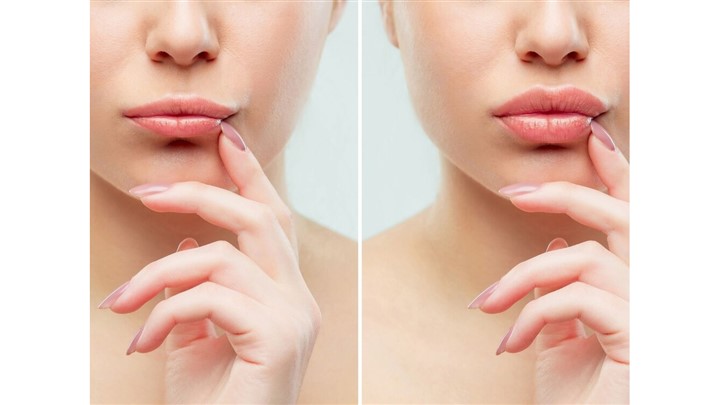 لب روسی، تکنیک ژل لب پرطرفدار لب روسی، تکنیک ژل لب پرطرفدار