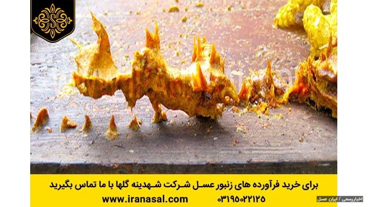 درمان کبد چرب درمان کبد چرب