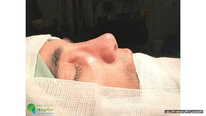 معرفی متخصص جراحی زیبایی بینی در شیراز معرفی متخصص جراحی زیبایی بینی در شیراز