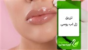 تزریق ژل لب روسی