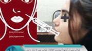 مراحل جراحی بینی | جوانب منفی و مثبت آن