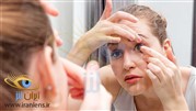 تازه کارهای لنز چشمی بخوانند