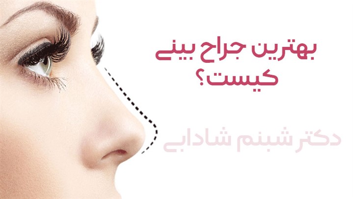 بهترین جراح بینی کیست؟ بهترین جراح بینی کیست؟