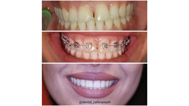 خالق لبخند زیبای بازیگران سینما خالق لبخند زیبای بازیگران سینما