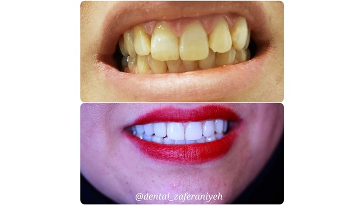 خالق لبخند زیبای بازیگران سینما خالق لبخند زیبای بازیگران سینما