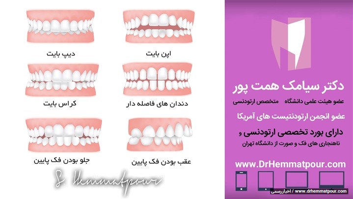 زمان‌ مناسب و فواید ارتودنسی کودکان را بشناسید