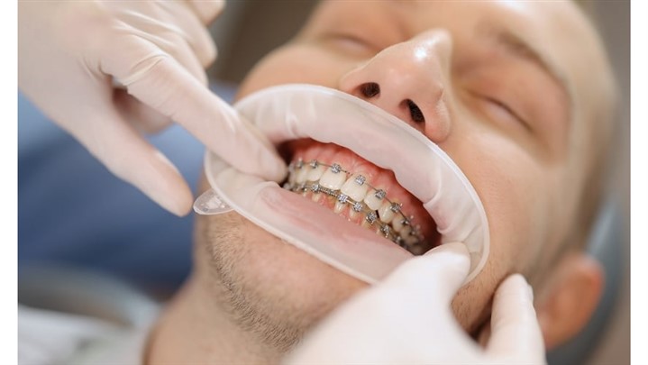 بهترین متخصص ارتودنسی در شهر شما: چگونه او را پیدا کنیم؟