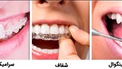 قبل از انجام ارتودنسی نامرئی یا مرئی مطالعه کنید! قبل از انجام ارتودنسی نامرئی یا مرئی مطالعه کنید!
