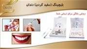 نحوه بلیچینگ(سفید کردن) دندان در خانه و مطب
