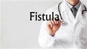 برای درمان فیستول به چه دکتر یا پزشک متخصص باید مراجعه کرد؟