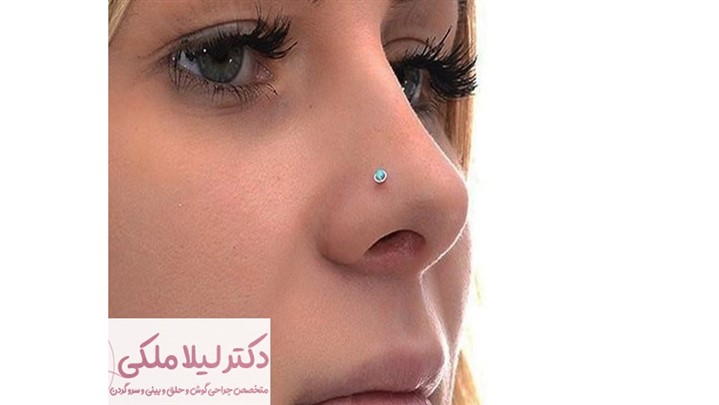 جراحی بینی فانتزی جراحی بینی فانتزی