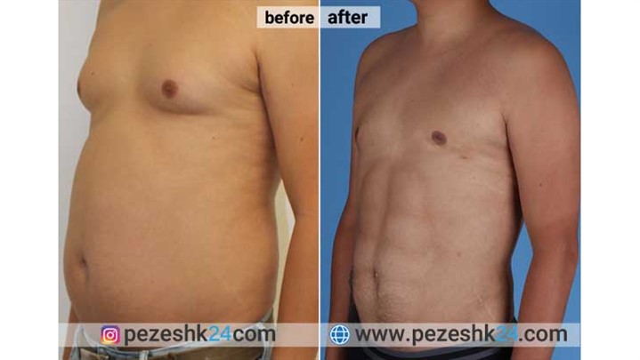 رزرو سریع عمل بینی با پزشک 24