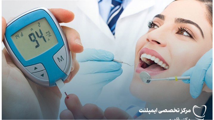 موفقیت ایمپلنت دندان برای بیماران دیابتی با رعایت کنترل قند خون