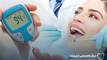 موفقیت ایمپلنت دندان برای بیماران دیابتی با رعایت کنترل قند خون