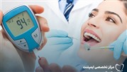 موفقیت ایمپلنت دندان برای بیماران دیابتی با رعایت کنترل قند خون