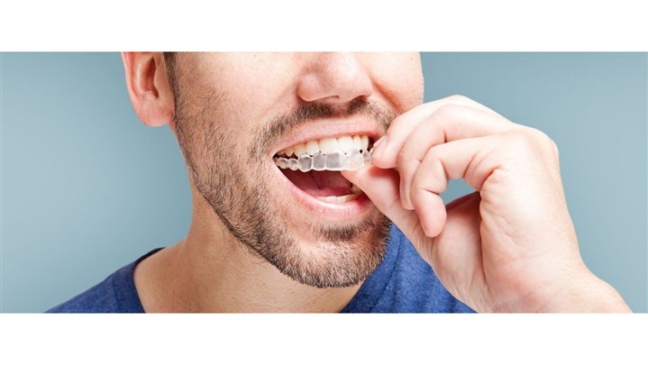 آیا ارتودنسی نامرئی واقعیت دارد؟