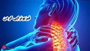 فیزیوتراپی گردن با روش های لیزر پرتوان، اولتراسوند و الکتروتراپی