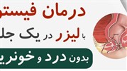 درمان فیستول مقعد با لیزر در کلینیک پایتخت