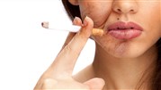 همه چیز درباره تاثیر سیگار بر سلامت پوست و مو همه چیز درباره تاثیر سیگار بر سلامت پوست و مو