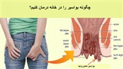 آیا هموروئید به طور کامل در خانه درمان می شود؟