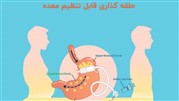بهترین عمل جراحی لاغری چیست؟ بهترین عمل جراحی لاغری چیست؟